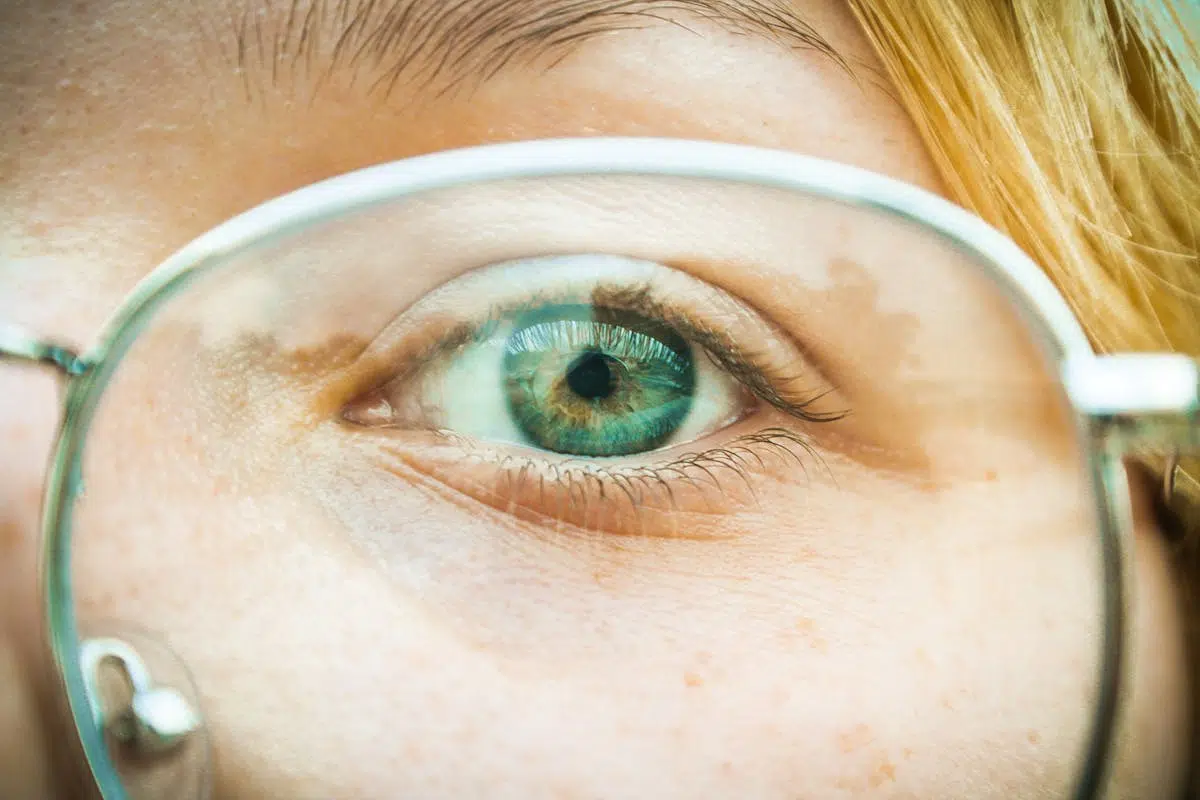Glaucomul sau patologia oftalmologică mută care te poate afecta fără să îți dai seama 1 - PrimaClinic.ro 1. Glaucomul-ce este_ochi verde cu rama de ochelari