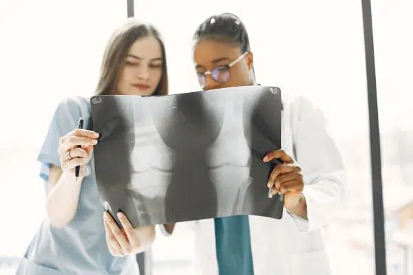 Artrita reumatoidă: etiologie, factori cauzali și opțiuni terapeutice pentru ameliorare 8 - PrimaClinic.ro 2.3. Poliartrita reumatoida simptome- cum evoluează- radiografie, picioare